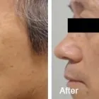 Business 46 image DR. POON COSMETIC MEDICINE INC Health & Medicine in Mississauga ON