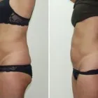 Business 5 image DR. POON COSMETIC MEDICINE INC Health & Medicine in Mississauga ON