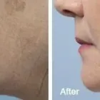 Business 9 image DR. POON COSMETIC MEDICINE INC Health & Medicine in Mississauga ON