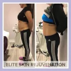 Business 3 image ELITE SKIN REJUVENATION Skin Care Clinics & Services in Woodbridge ON