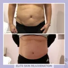 Business 7 image ELITE SKIN REJUVENATION Skin Care Clinics & Services in Woodbridge ON