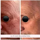 Business 2 image ELITE SKIN REJUVENATION Skin Care Clinics & Services in Woodbridge ON