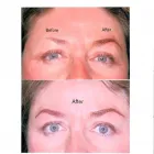 Business 1 image ENHANCE STUDIO MEDI-SPA Skin Care Clinics & Services in Vernon BC