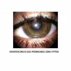Entreprises 8 image HAMPTON PARK OPTOMETRY Ophthalmologists, Optometrists & Opticians dans Ottawa ON