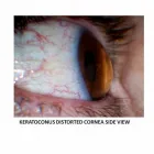 Entreprises 4 image HAMPTON PARK OPTOMETRY Ophthalmologists, Optometrists & Opticians dans Ottawa ON