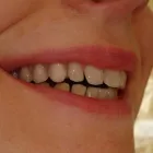 Business 8 image HARBOUR CITY DENTURE Health & Medicine in Nanaimo BC