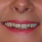 Business 9 image HARBOUR CITY DENTURE Health & Medicine in Nanaimo BC