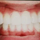 Entreprises 8 image HERITAGE VILLAGE DENTAL CLINIC Health & Medicine dans Edmonton AB