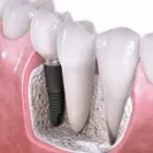 Business 2 image HUMMINGBIRD DENTAL CLINIC - FAMILY DENTIST OPEN FOR REGULAR BUSINESS SERVING RICHMOND HILL in Richmond Hill ON