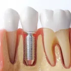 Business 4 image HUMMINGBIRD DENTAL CLINIC - FAMILY DENTIST OPEN FOR REGULAR BUSINESS SERVING RICHMOND HILL in Richmond Hill ON