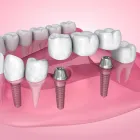 Entreprises 9 image KEELE CROSSTOWN DENTAL Dentures dans York ON