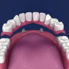 Entreprises 13 image KEELE CROSSTOWN DENTAL Dentures dans York ON