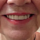 Entreprises 4 image MARIELLE GIASSON DENTUROLOGISTE Health & Medicine dans Saint-Laurent QC