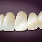 Business 2 image MARKHAM STOUFFVILLE DENTURE SPECIALISTS Health & Medicine in Markham ON