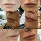 Entreprises 5 image MINI MED CLINIC Plastic & Cosmetic Surgery dans Etobicoke ON