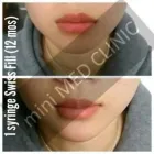 Entreprises 6 image MINI MED CLINIC Plastic & Cosmetic Surgery dans Etobicoke ON