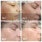 Entreprises 7 image MINI MED CLINIC Plastic & Cosmetic Surgery dans Etobicoke ON