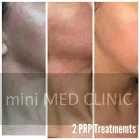 Entreprises 8 image MINI MED CLINIC Plastic & Cosmetic Surgery dans Etobicoke ON