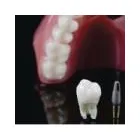 Entreprises 3 image NOSI DENTURE CLINIC Health & Medicine dans Toronto ON