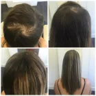 Business 14 image PACIFIC HAIR LOSS SOLUTIONS Wigs & Hairpieces in Vancouver BC