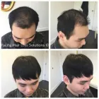Business 19 image PACIFIC HAIR LOSS SOLUTIONS Wigs & Hairpieces in Vancouver BC