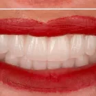 Business 5 image PARKVIEW DENTAL AND IMPLANT CENTRE Dentists & Dental Clinics in Vancouver BC