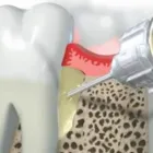 Business 12 image PETRICCA GIORGIO DR INC Health & Medicine in Nanaimo BC