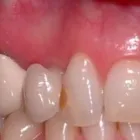 Business 17 image PETRICCA GIORGIO DR INC Health & Medicine in Nanaimo BC