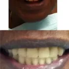 Business 3 image QUINTE DENTURE CLINIC Health & Medicine in Belleville ON