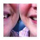 Business 6 image QUINTE DENTURE CLINIC Health & Medicine in Belleville ON