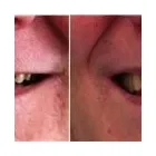 Business 8 image QUINTE DENTURE CLINIC Health & Medicine in Belleville ON