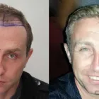 Business 12 image RAHAL HAIR TRANSPLANT TORONTO Health & Medicine in North York ON