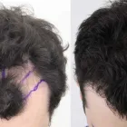 Business 14 image RAHAL HAIR TRANSPLANT TORONTO Health & Medicine in North York ON