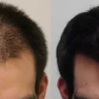 Business 16 image RAHAL HAIR TRANSPLANT TORONTO Health & Medicine in North York ON
