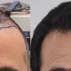Business 2 image RAHAL HAIR TRANSPLANT TORONTO Health & Medicine in North York ON