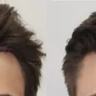 Business 20 image RAHAL HAIR TRANSPLANT TORONTO Health & Medicine in North York ON