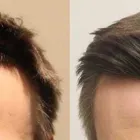 Business 21 image RAHAL HAIR TRANSPLANT TORONTO Health & Medicine in North York ON
