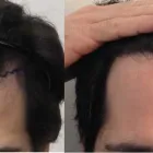 Business 22 image RAHAL HAIR TRANSPLANT TORONTO Health & Medicine in North York ON