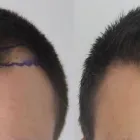 Business 23 image RAHAL HAIR TRANSPLANT TORONTO Health & Medicine in North York ON