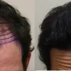 Business 24 image RAHAL HAIR TRANSPLANT TORONTO Health & Medicine in North York ON