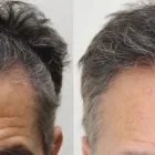 Business 25 image RAHAL HAIR TRANSPLANT TORONTO Health & Medicine in North York ON