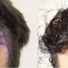 Business 26 image RAHAL HAIR TRANSPLANT TORONTO Health & Medicine in North York ON