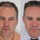 Business 27 image RAHAL HAIR TRANSPLANT TORONTO Health & Medicine in North York ON