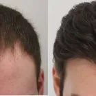 Business 28 image RAHAL HAIR TRANSPLANT TORONTO Health & Medicine in North York ON