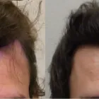 Business 3 image RAHAL HAIR TRANSPLANT TORONTO Health & Medicine in North York ON