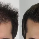 Business 32 image RAHAL HAIR TRANSPLANT TORONTO Health & Medicine in North York ON