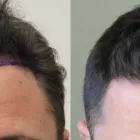 Business 33 image RAHAL HAIR TRANSPLANT TORONTO Health & Medicine in North York ON