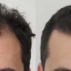 Business 35 image RAHAL HAIR TRANSPLANT TORONTO Health & Medicine in North York ON