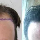 Business 5 image RAHAL HAIR TRANSPLANT TORONTO Health & Medicine in North York ON