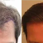 Business 6 image RAHAL HAIR TRANSPLANT TORONTO Health & Medicine in North York ON
